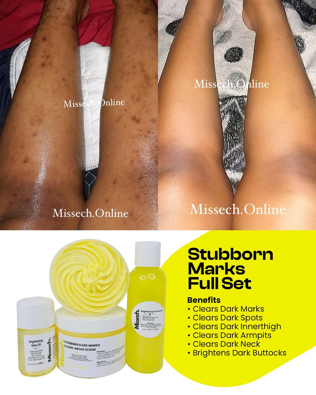 Stubborn Dark Marks & Stubborn Dark Areas Full Set