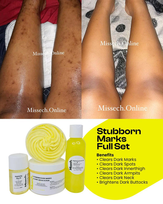 Stubborn Dark Marks & Stubborn Dark Areas Full Set